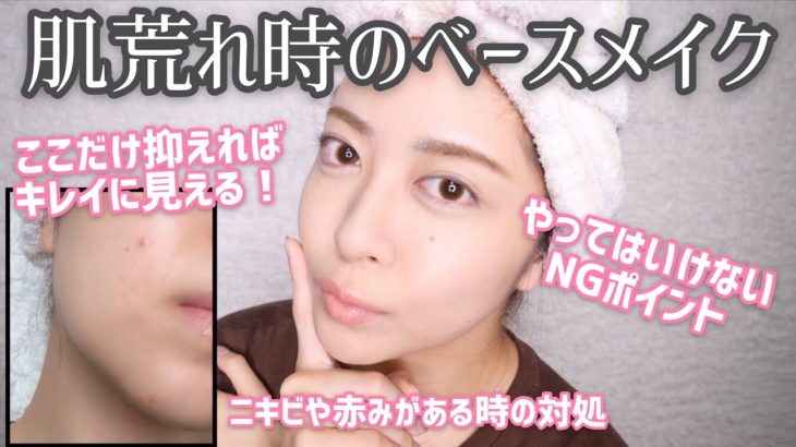 【最新版】肌荒れした時のベースメイク方法！ニキビが出来てても綺麗に仕上がる✨注意点やポイントも！【プチプラ/デパコス/ナチュラルコスメ】