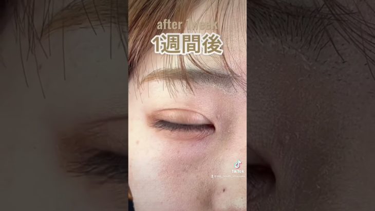 【20代 女性】ナチュラルメイクが似合うオトナ女子に似合う二重ラインに✨