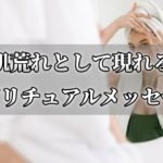 肌トラブルとして届くメッセージ！原因やスピリチュアルな意味とは？【チャンネルダイス】音声付き