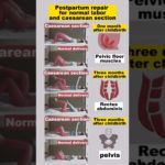 Yoga Pilates-Reduce Belly Fat#short #reducebellyfat #bellyfatloss #yoga