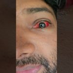 Do you Agree? Stress depletes your Mental Well Being