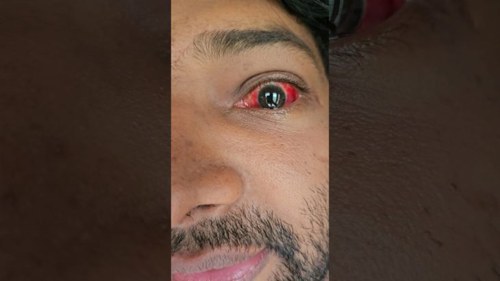 Do you Agree? Stress depletes your Mental Well Being