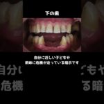 歯が抜ける夢を見ると宝くじが当たる？？ #スピリチュアル