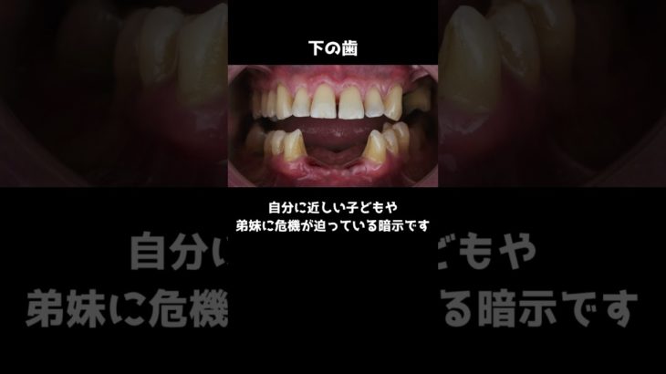 歯が抜ける夢を見ると宝くじが当たる？？ #スピリチュアル