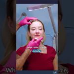 Mom Glows Up with Fillers and Fitness