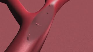 Living with sickle cell (Part 1) | 2 Your Well Being