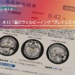WELL BEING FRONTIER vol 33『脳のウェルビーイング “ブレインスイート”とは？ 』2025.9.13放送