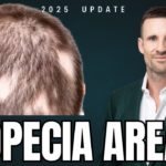Alopecia Areata 2025: Treatments That Work & Holistic Wellbeing Plan — Doctor Explains