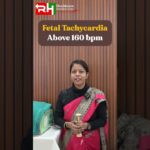 Fetal Heart Rate (FHR) — Monitoring The Baby’s Well-Being #FetalHeartRate #FHR #OBGYN