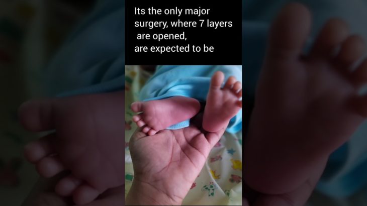 all a mother wishes is the wellbeing of her baby #viralvideo #ytshorts #trending